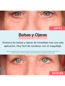 Remescar bolsas y ojeras vegetal 8 ml