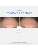 Neostrata discos glycopeel 36 unidades